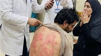 وجدت ثلاثين بقعة 